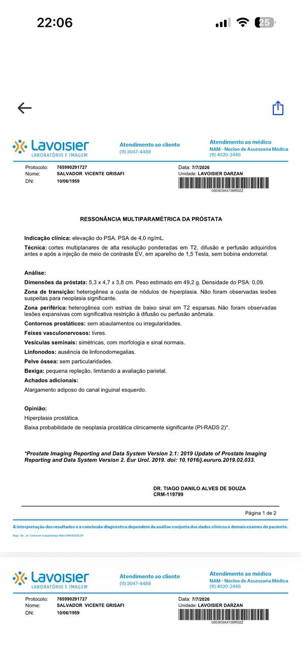 Telhas galvanizadas e containers  - Foto 3