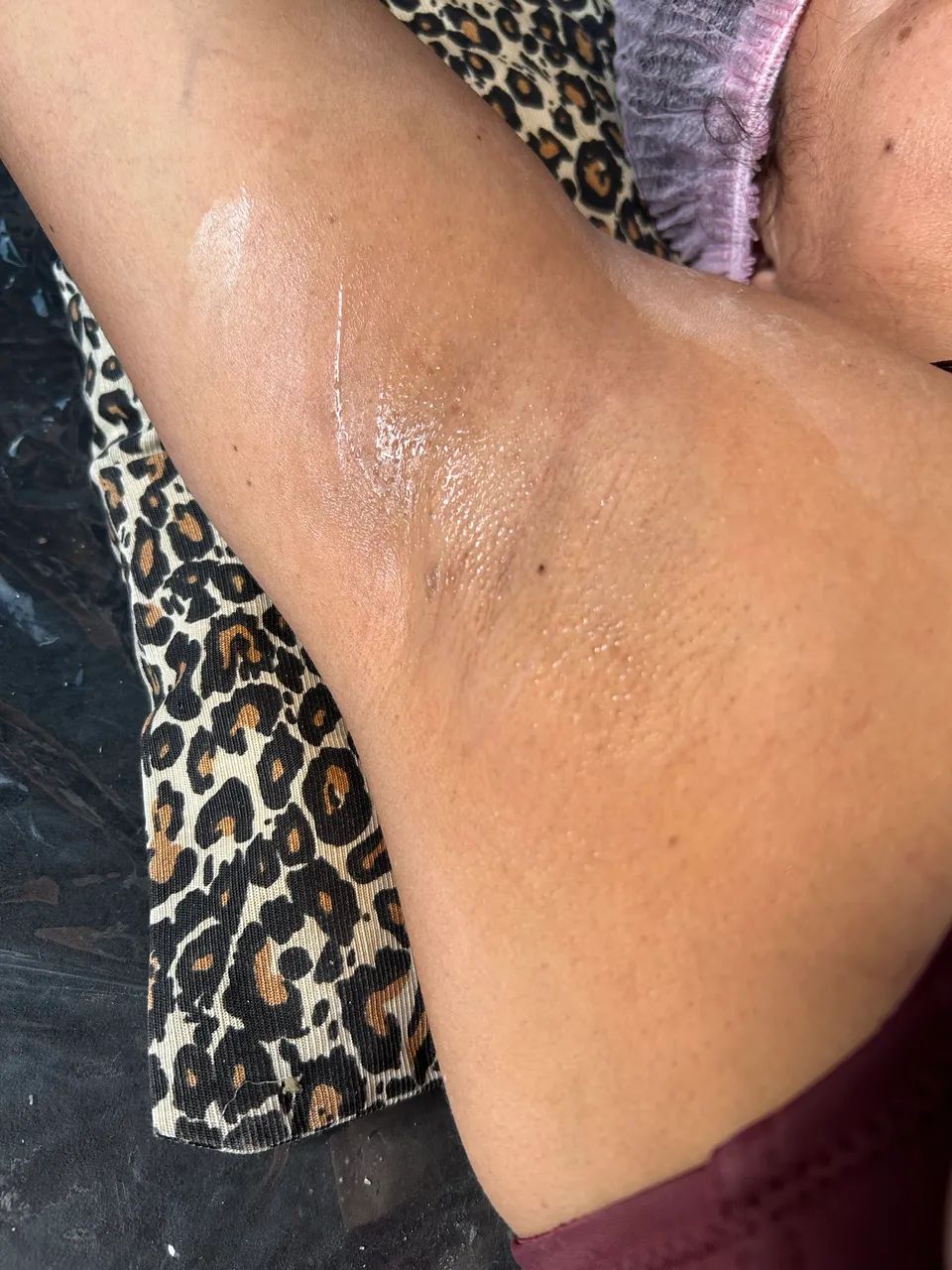 Depilação com cera em Vila Velha  - Foto 3