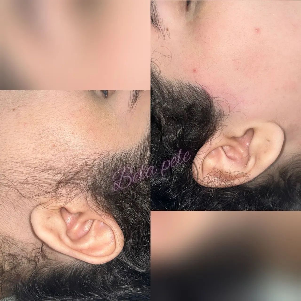 Depil e Estética FEM. / MAS. - Foto 4