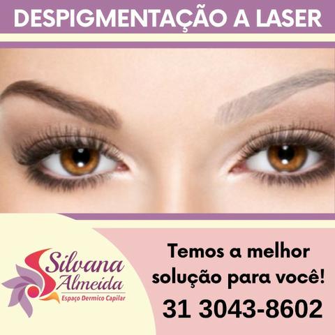 Remoção de Tatuagem à laser em Floripa apagar tatuagem em Floripa - Foto 3