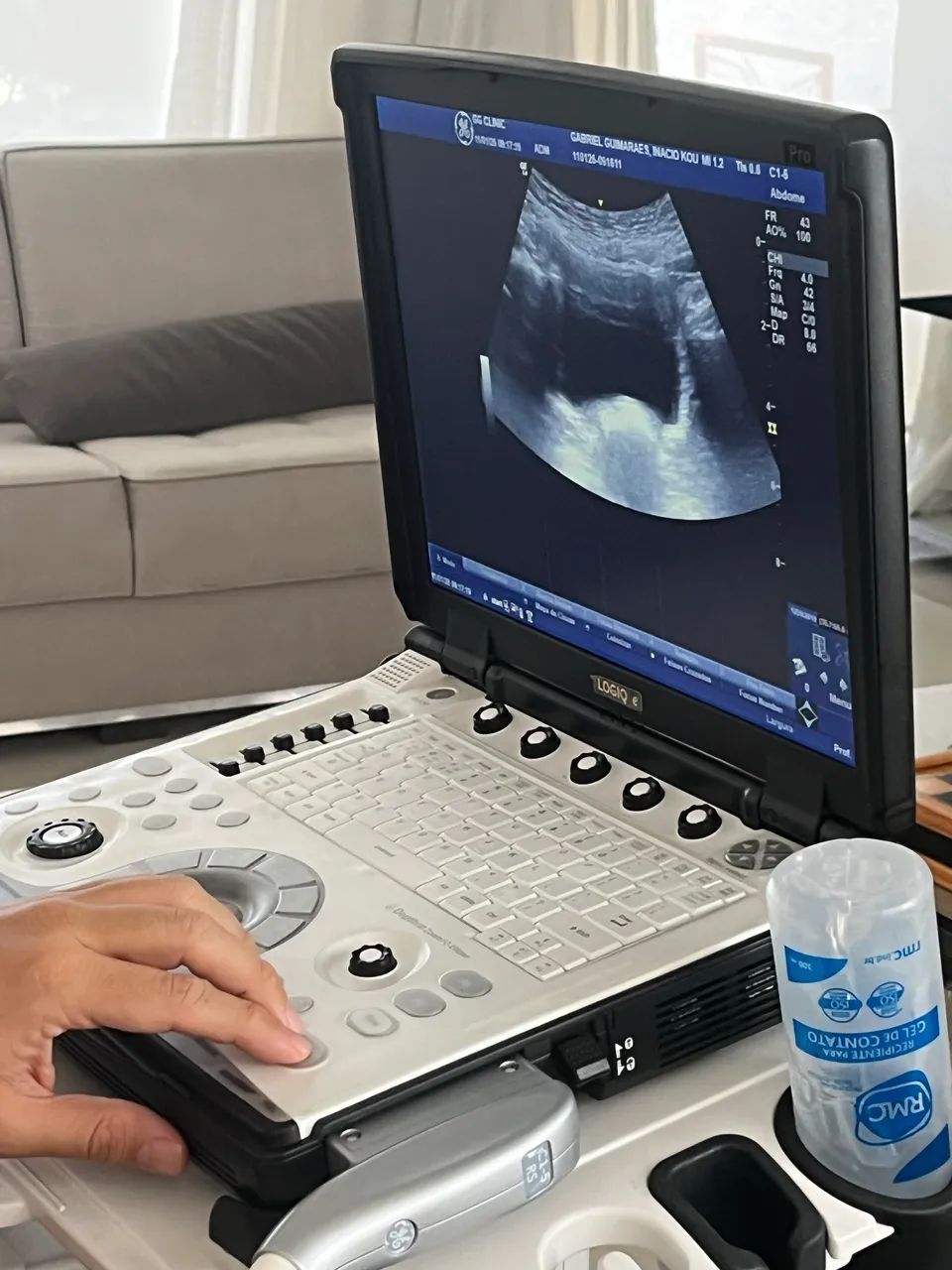 Ultrassom logique GE portátil  - Foto 5