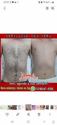 Depila ção  homens e mulheres  - Foto 2