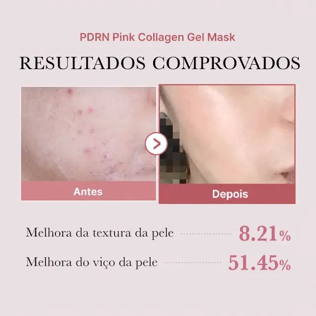 Kit 4 Máscaras Medicube PDRN Pink Collagen Gel 28g - Foto 2