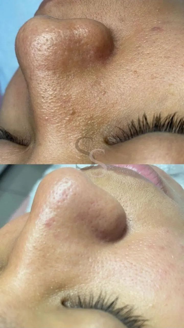 ESTETICISTA (CLAREAMENTO FACIAL/CORPORAL) - Foto 4