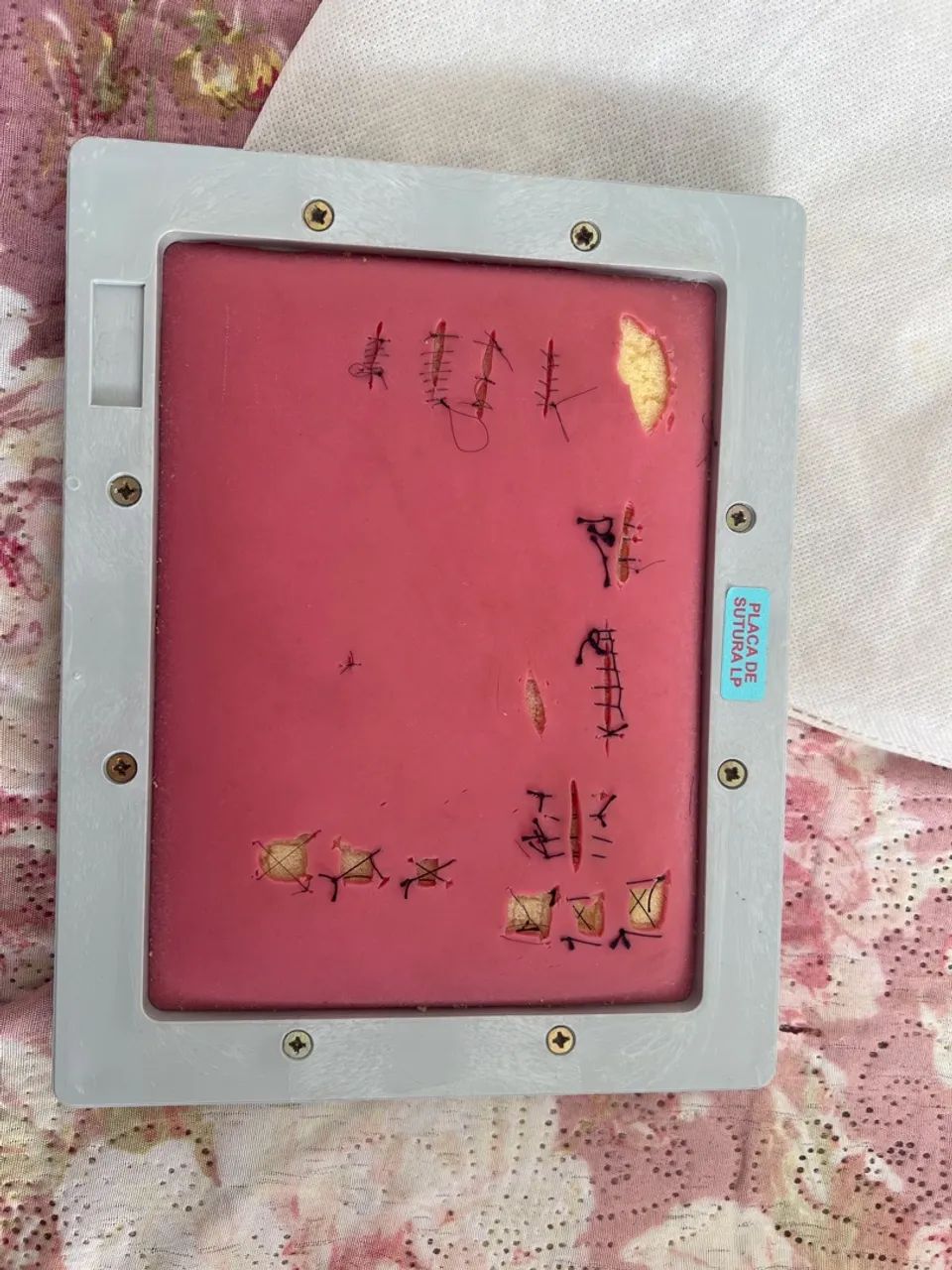 Placa de sutura