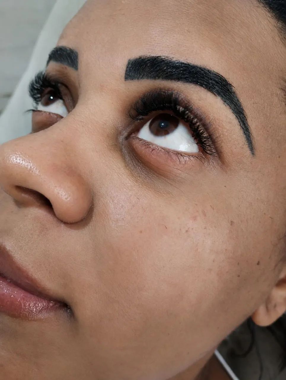 PROCEDIMENTOS ESTETICOS 