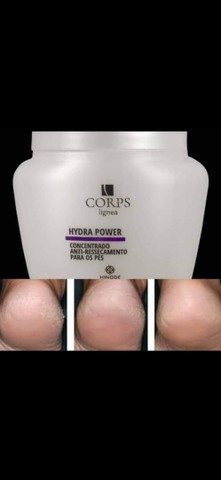 Antirachadura para os Pés  - Foto 5