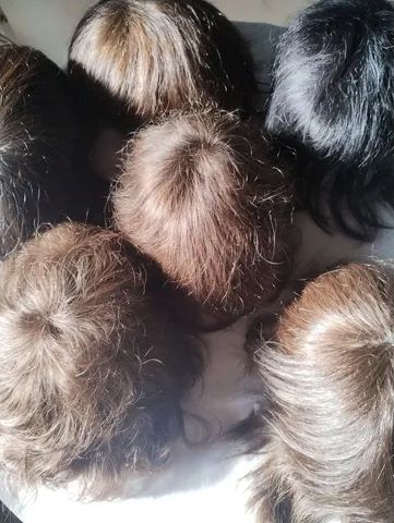 Prótese Capilar Nacional com Aplicação Micropele Cabelos Humano Brasileiro  - Foto 5