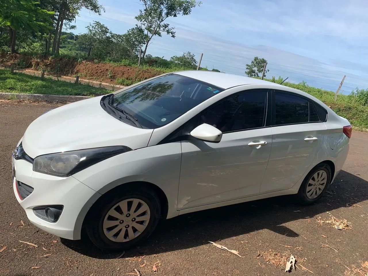 Hyundai Hb20S 2015