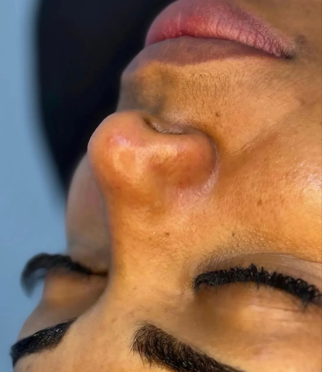 Limpeza de Pele Profunda