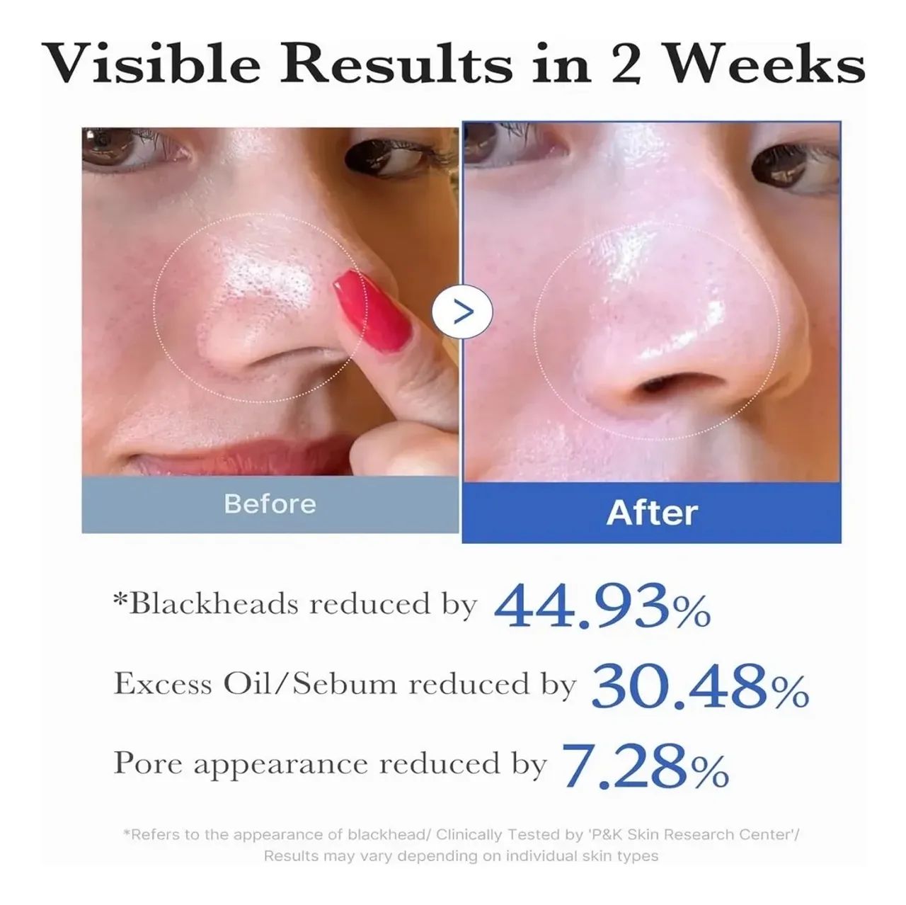 Medicube Zero Pore Pad 2.0 - Foto 4