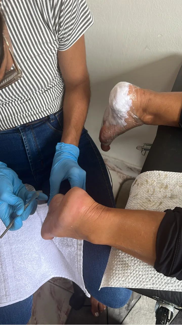 Tratamento pros pés  - Foto 3