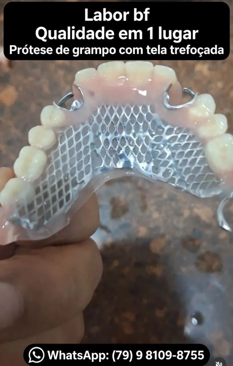 Laboratório de protese dentaria 