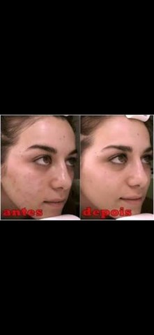 Clareador de pele Hinode  - Foto 2