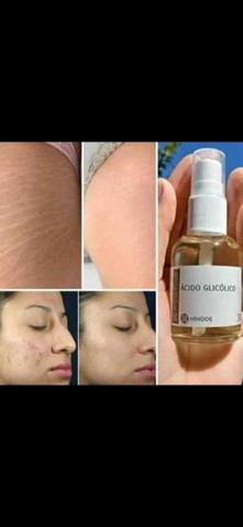 Clareador de pele Hinode  - Foto 5