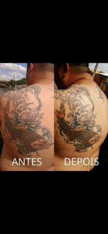 Hidratante para Tatuagens  - Foto 4
