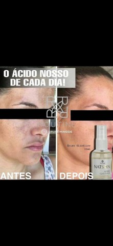 Clareador de pele Hinode  - Foto 3