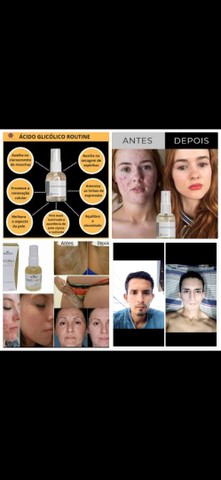 Clareador de pele Hinode 