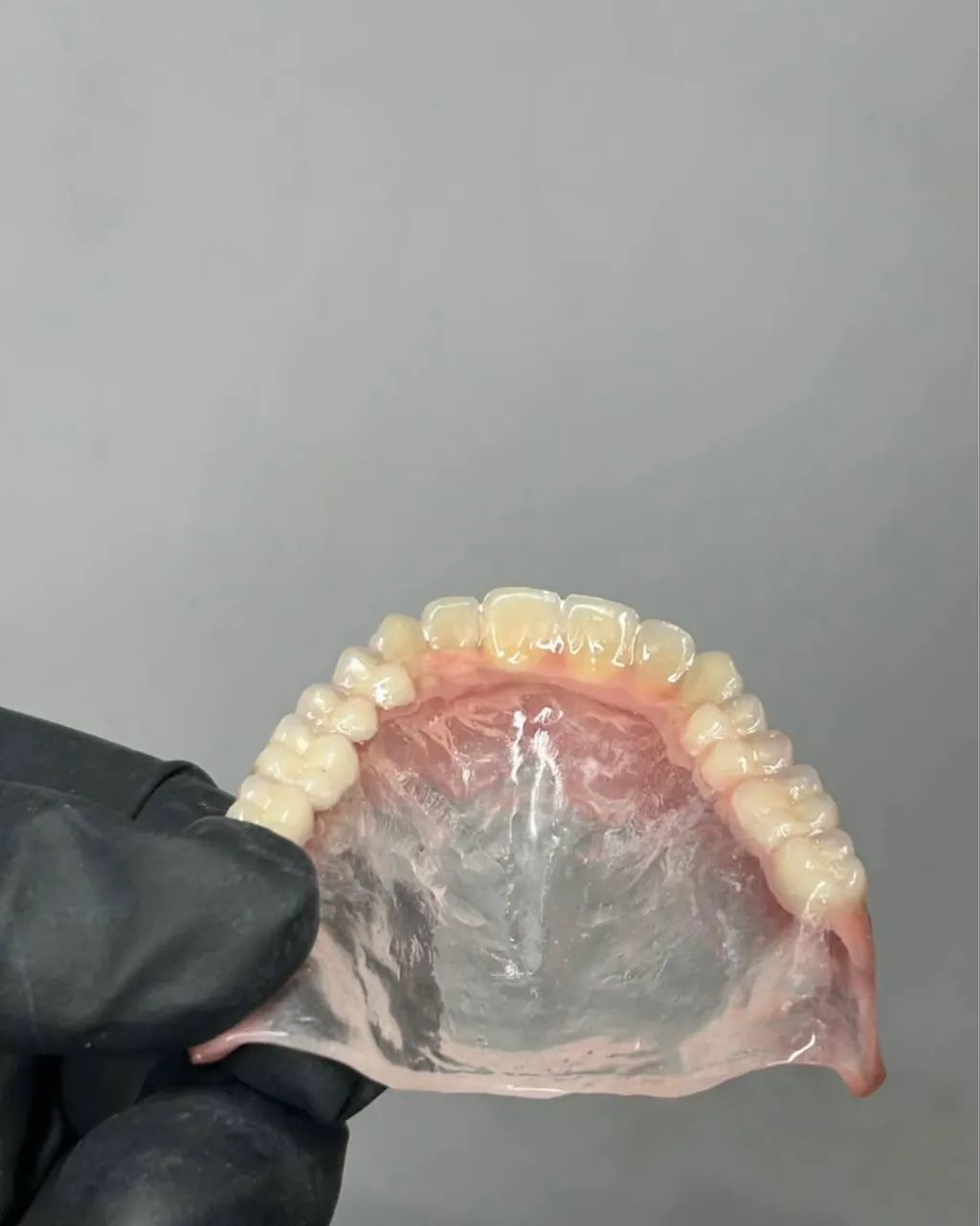 Prótese dentária  - Foto 2