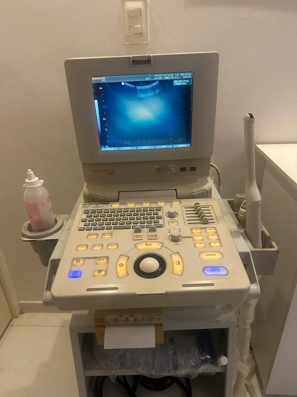 Ultrassom completo com carrinho e empressora 