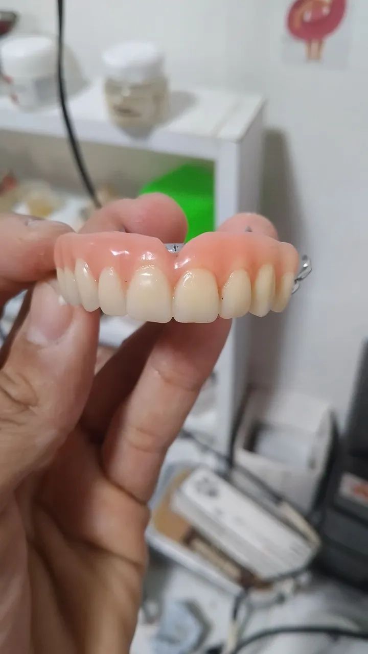 Prótese dentária  - Foto 5