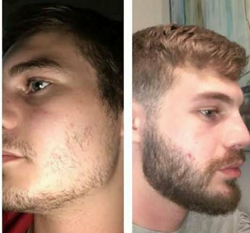 Produto para crescer barba, cabelos e sobrancelhas - Foto 3