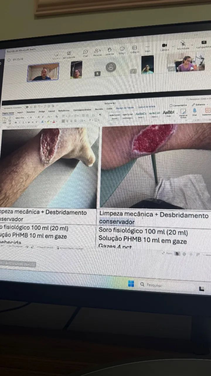 TRATAMENTO DE FERIDAS - Foto 4