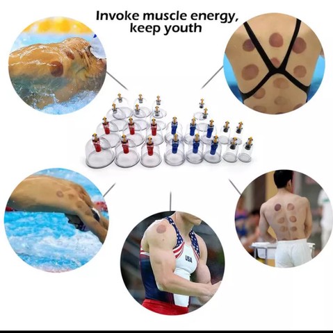 Ventosas (Leia o anúncio) - Foto 3