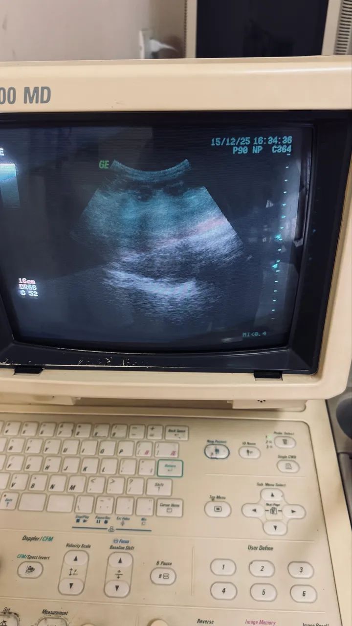 Aparelho Ultrassom GE Logiq - Foto 4