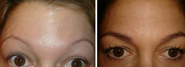 Produto para crescer barba, cabelos e sobrancelhas - Foto 5