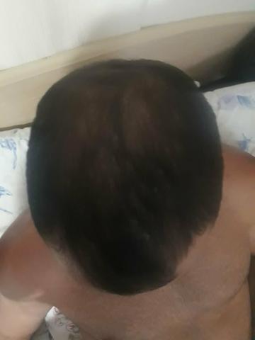 Produto para crescer barba, cabelos e sobrancelhas - Foto 2