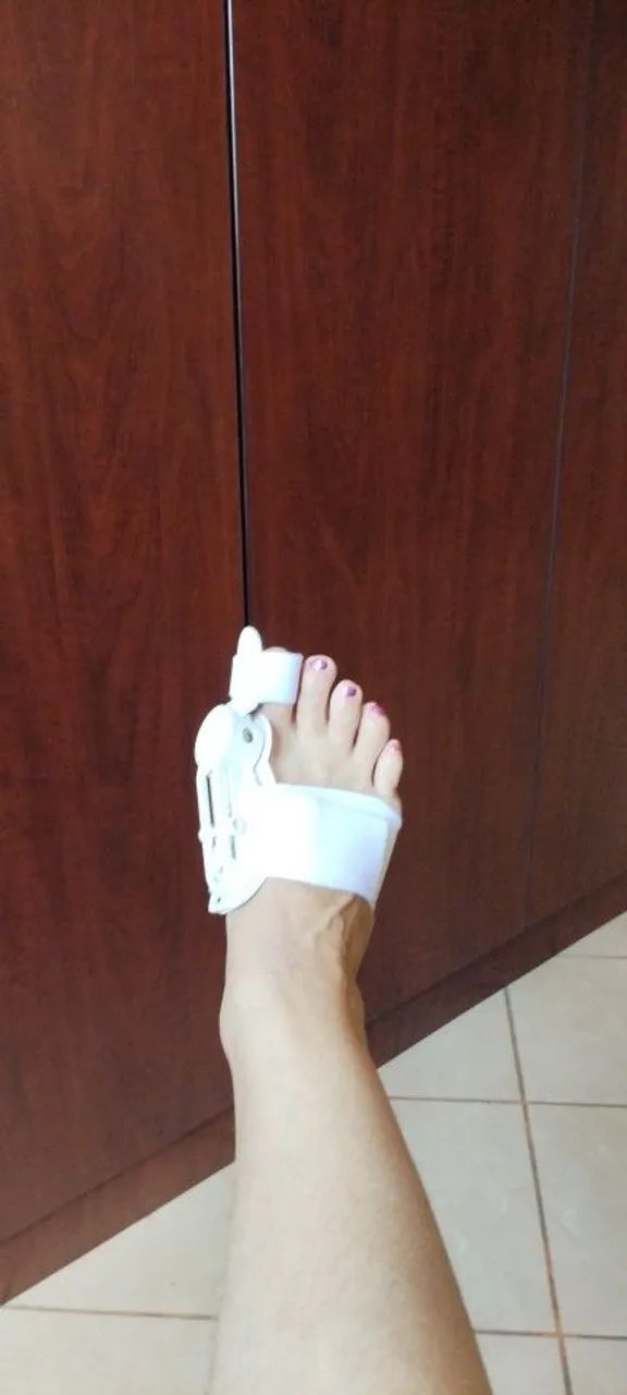 Correção de Hálux Valgo - Separador de Dedos - Foto 2