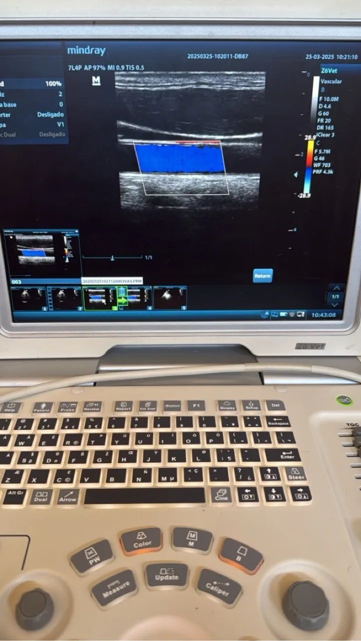 Ultrassom Mindray Z6