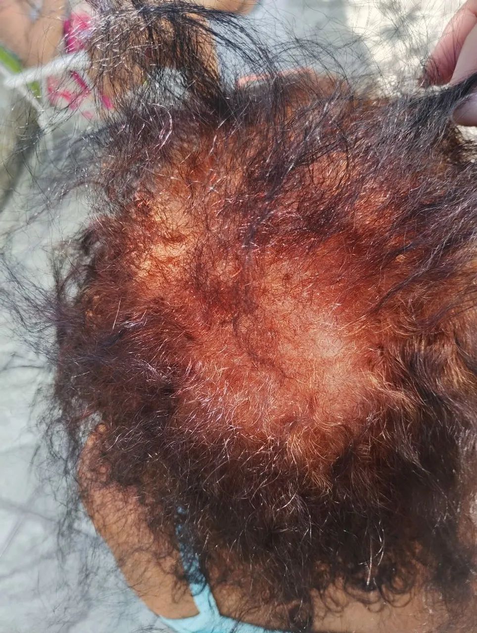 Colocação de megahair  - Foto 3