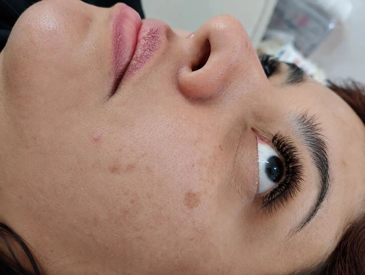 PROCEDIMENTOS ESTETICOS  - Foto 3