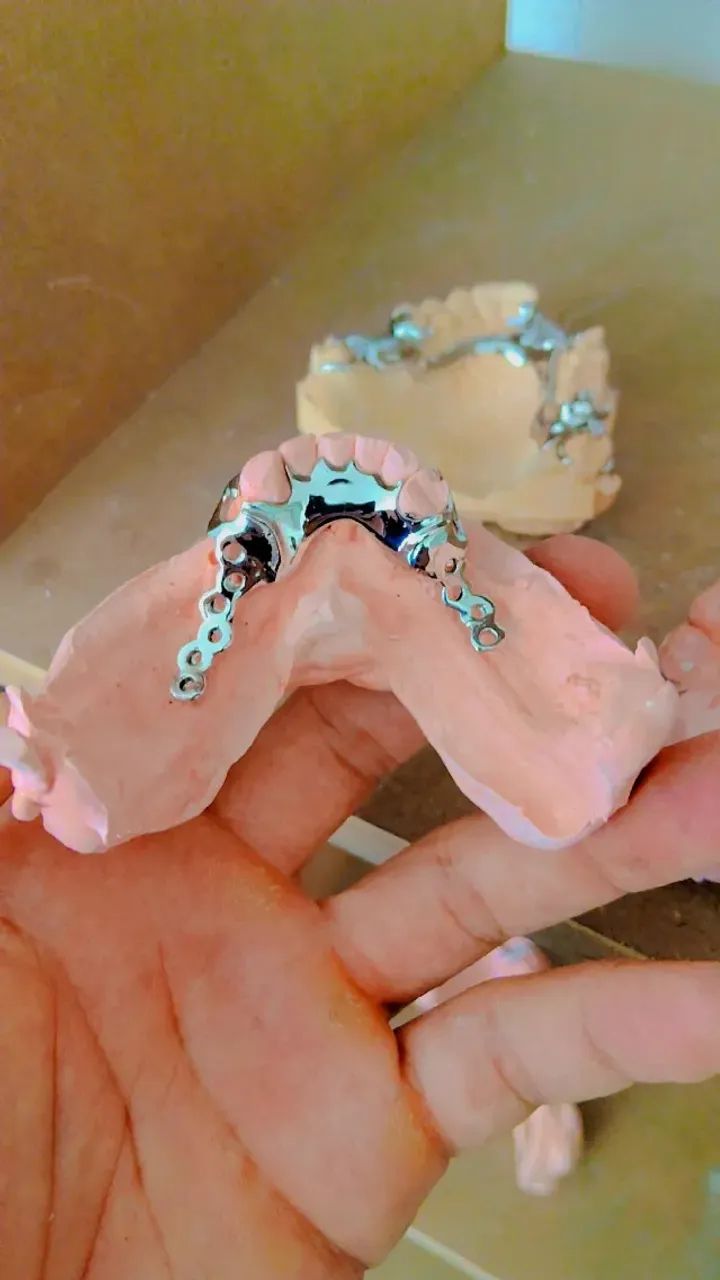 Dentadura 