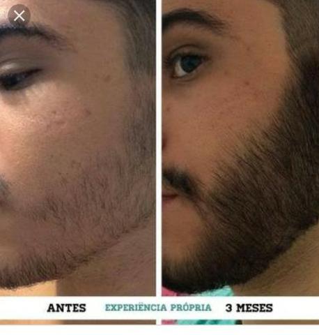 Loçao capilar pra barba falhada
