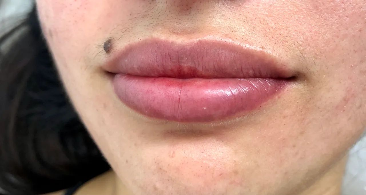 MODELO PARA MICROPIGMENTAÇÃO LABIAL - VALOR ESPECIAL - Foto 3