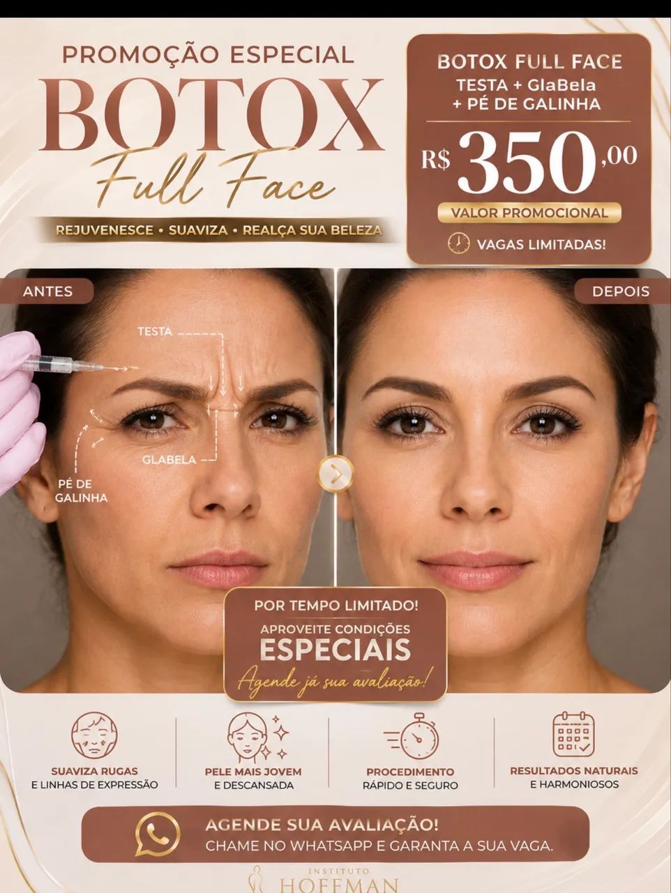 Paciente modelo para botox 