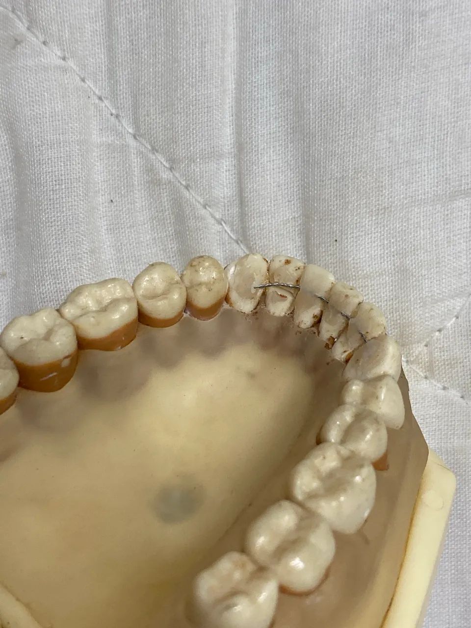 Manequim de periodontia (orais) - Foto 2