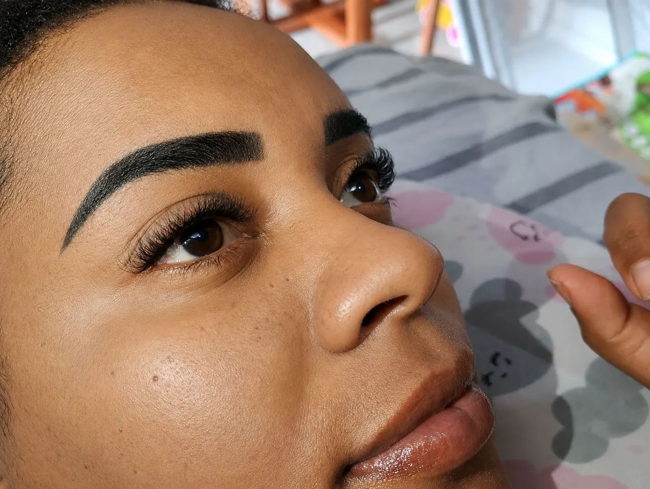 PROCEDIMENTOS ESTETICOS  - Foto 4