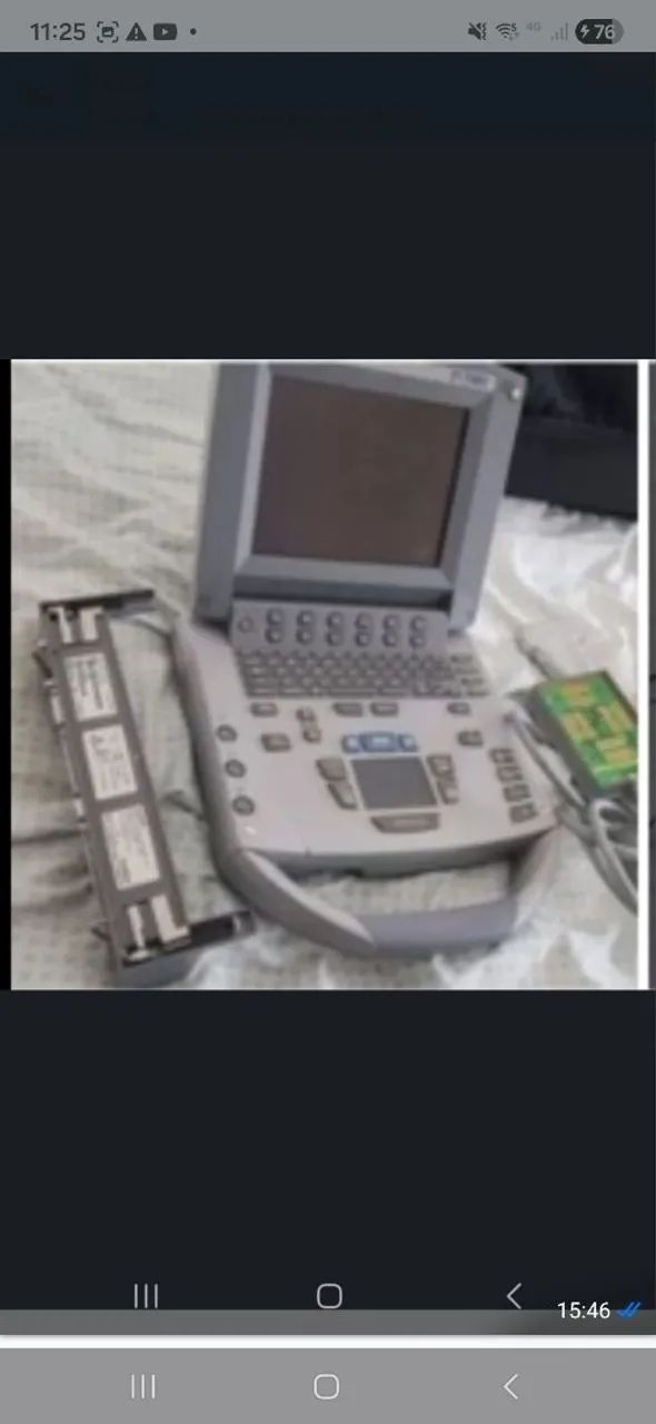 Sonosite ultrasson  Titan 