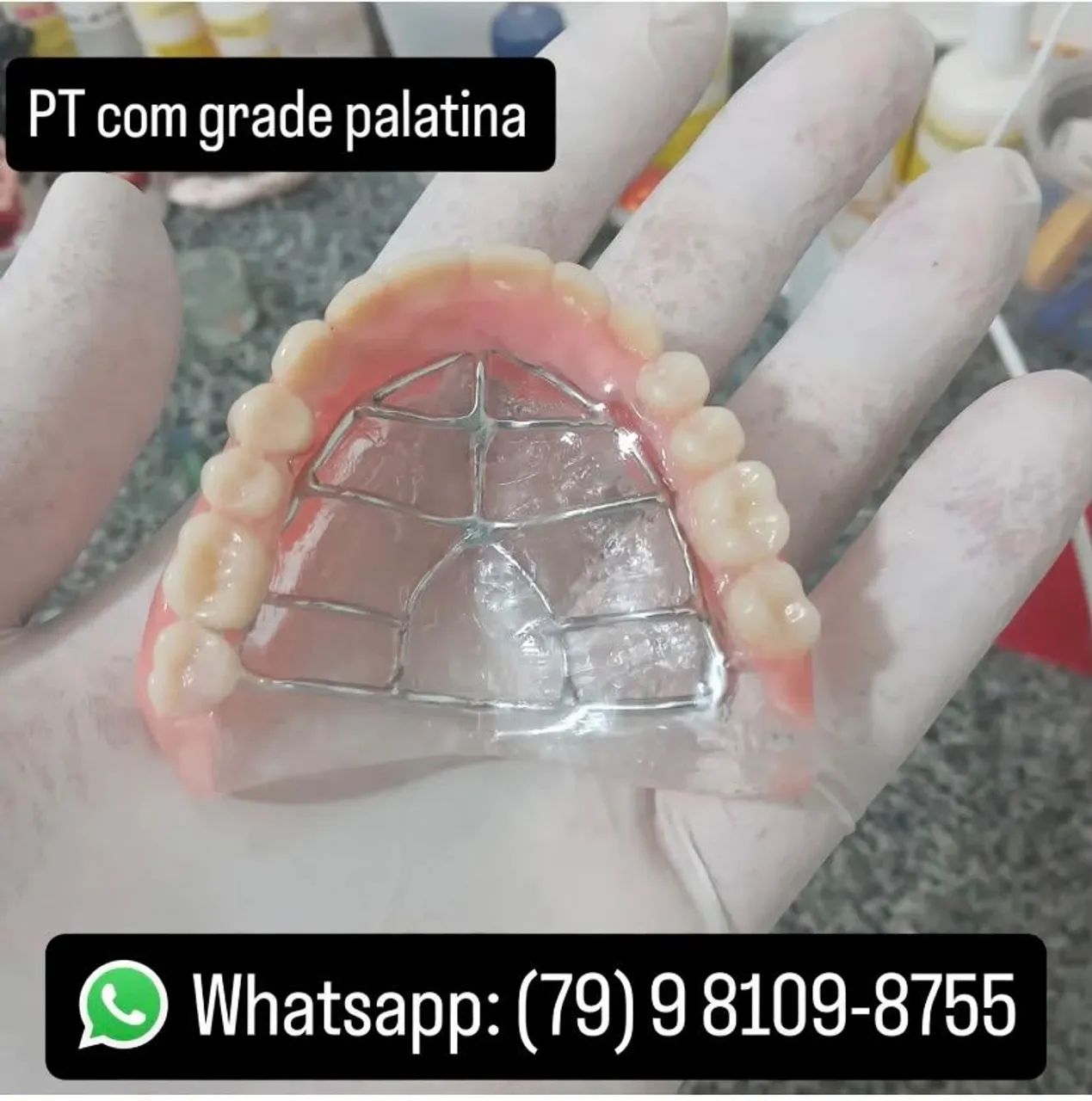 Laboratório de protese dentaria  - Foto 3