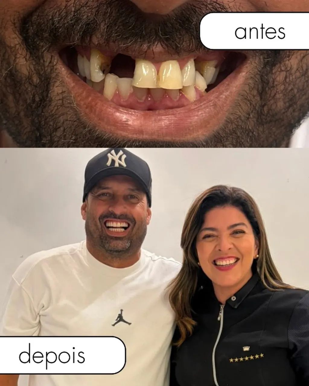 Próteses Fixas  - Foto 4