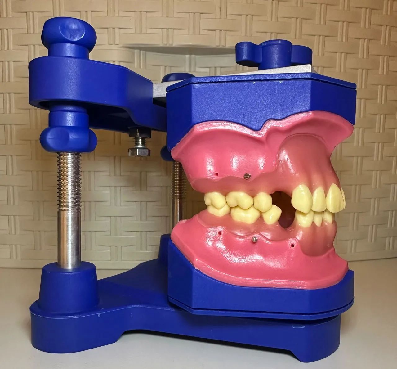 Manequim OrtoArt - Typodont Completo + Mini-Implante<br> - Foto 2