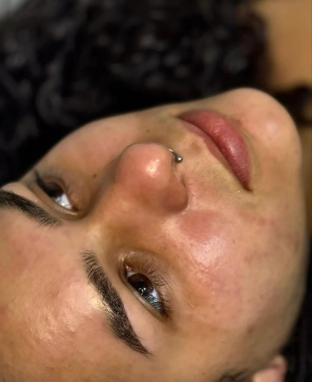 Limpeza de Pele Profunda - Foto 3