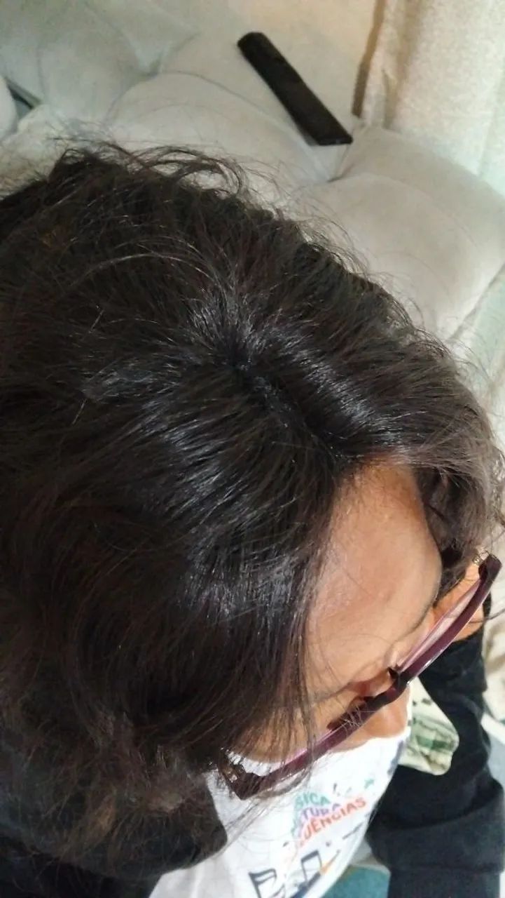 Topo de cabelo humano  - Foto 3