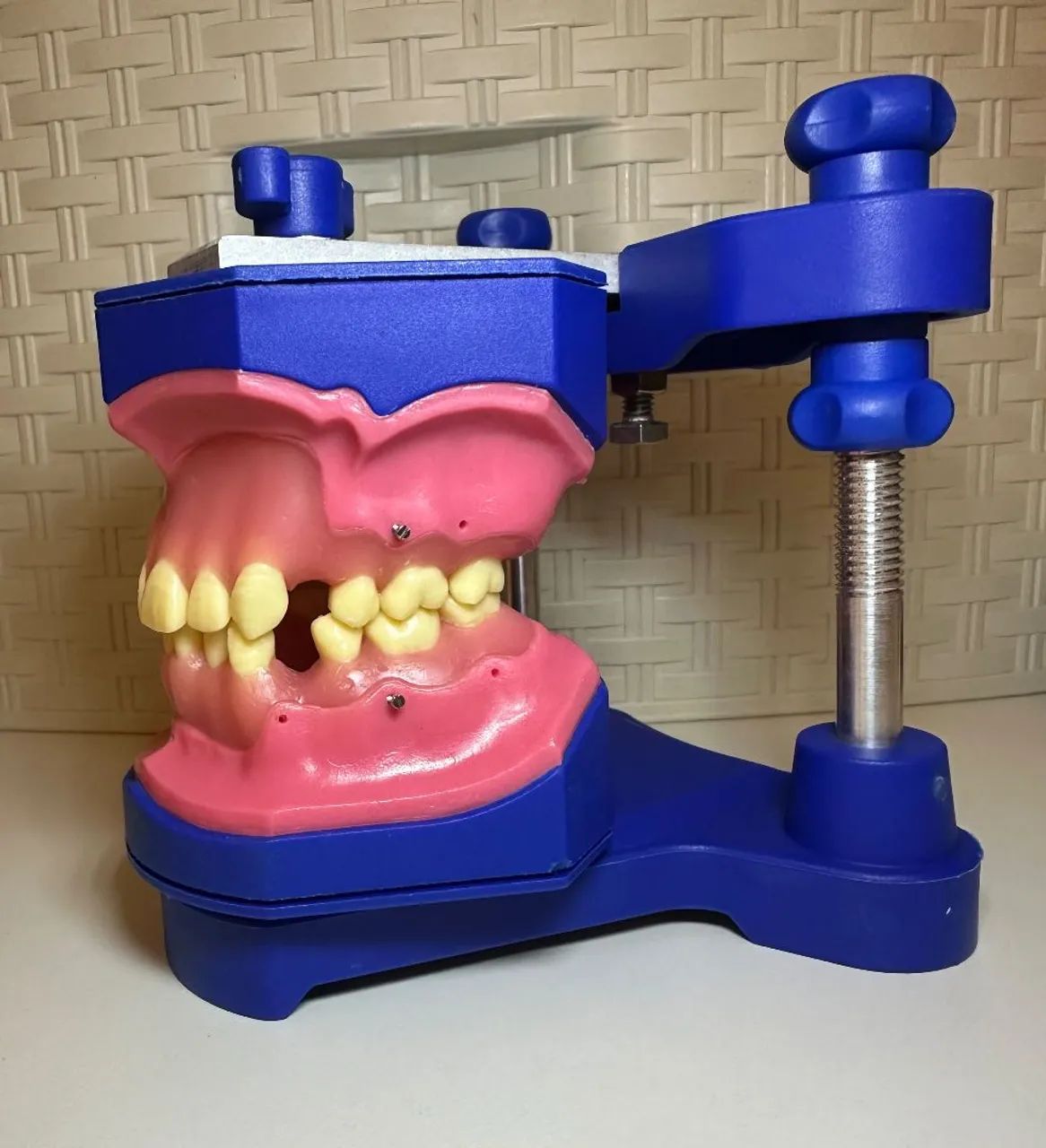 Manequim OrtoArt - Typodont Completo + Mini-Implante<br> - Foto 3