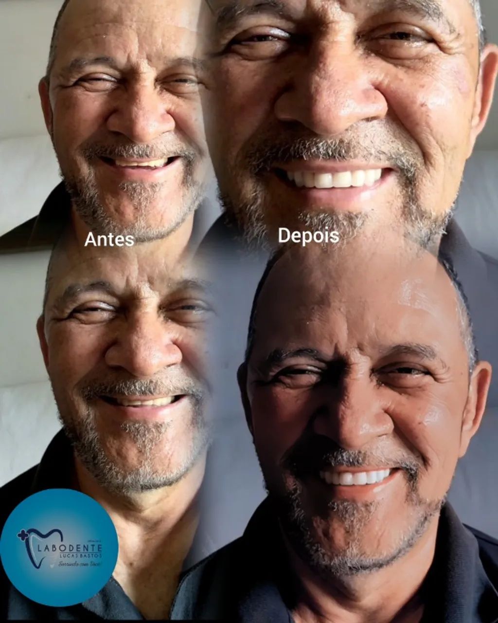 Dentadura  - Foto 4