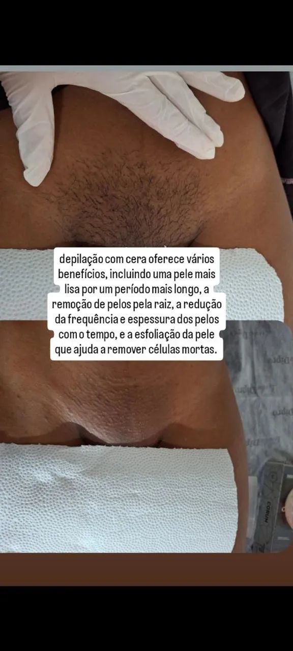 Depilação de cera